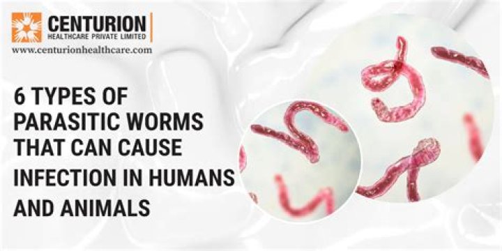 Can worms cause body pains?