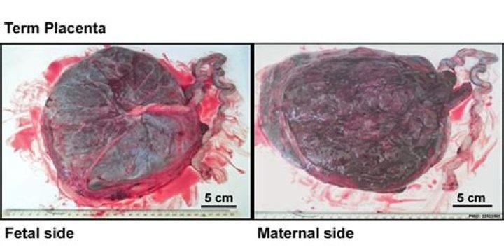 Do males have a placenta?