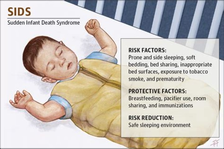 How common is SIDS 2020?
