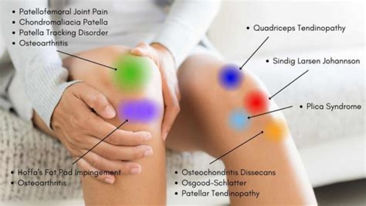 How long does it take for bursitis of the knee to go away?